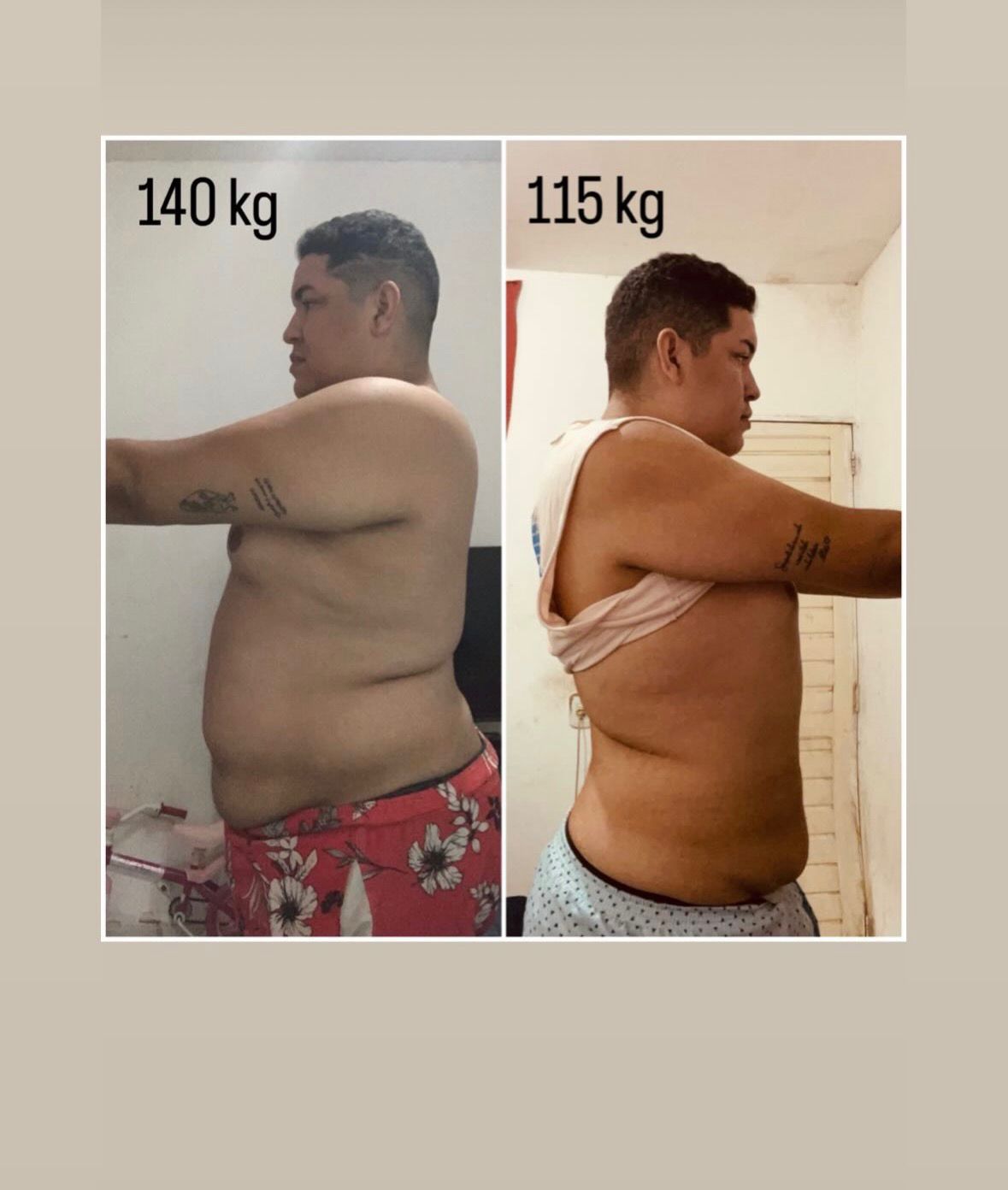 Comparação da evolução de um paciente que saiu de 140 kg para 115 kg