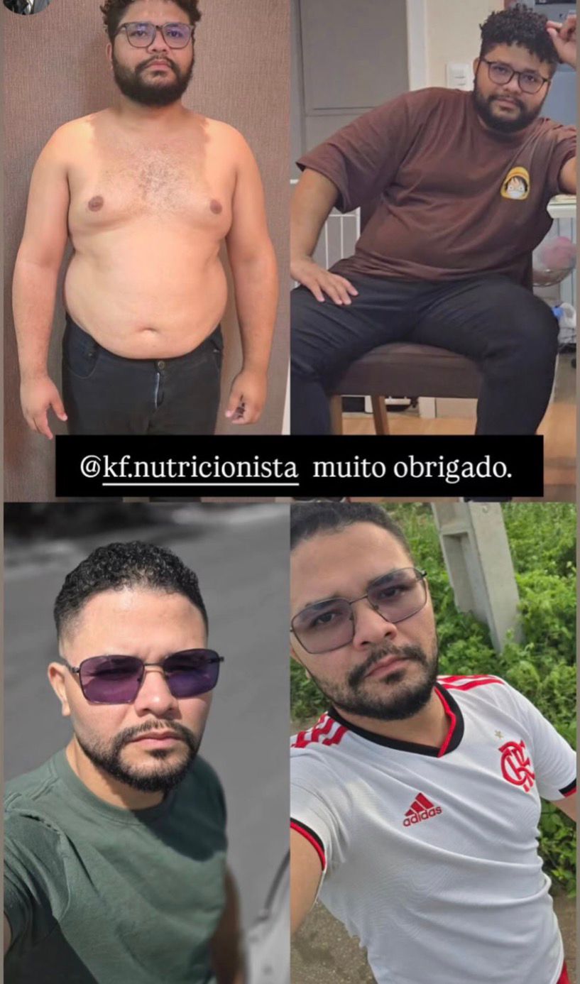 Comparação da evolução de um paciente ao longo do acompanhamento nutricional